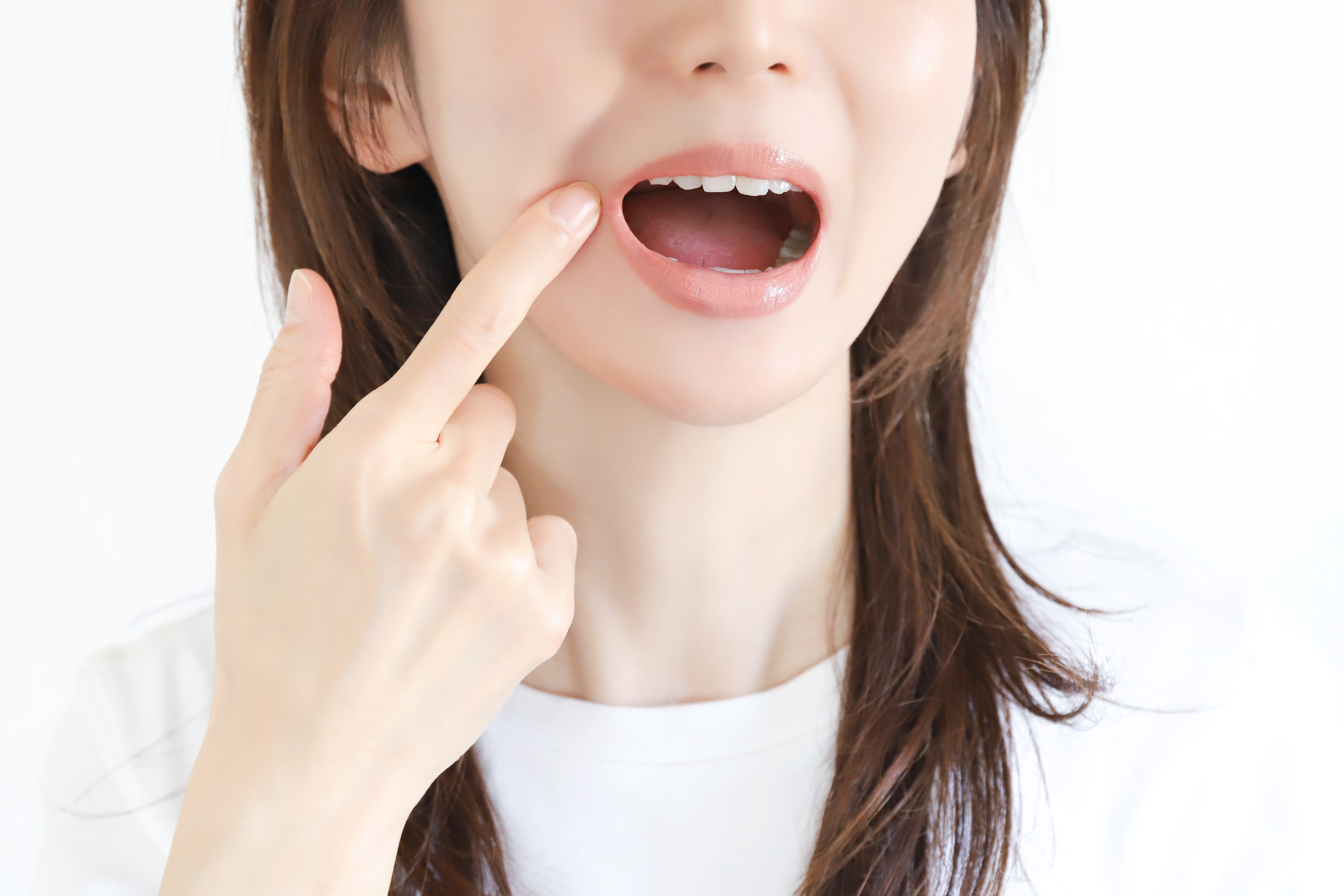 詰め物・被せ物が取れてしまった場合、それを持っていくべき？